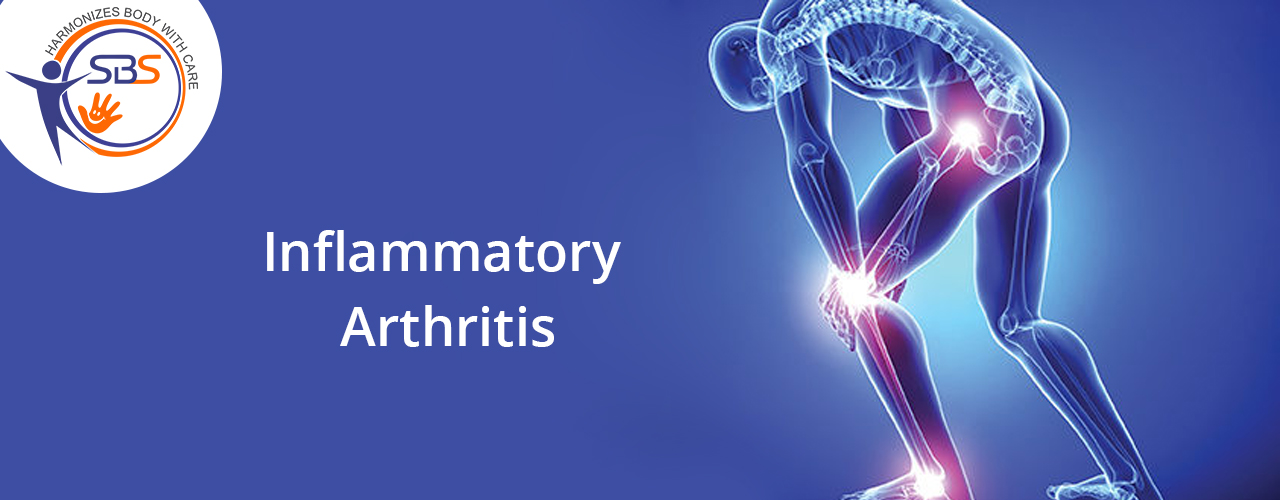 SBS Rehabilitation Center | Inflammatory Arthritis and its treatment ...